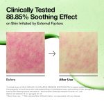Anua Azelaic Acid 10 Hyaluron Redness Soothing Pad (90ea) - Image 5