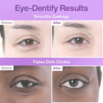 Numbuzin No.9 NAD Under Eye Patches (5ea) - Image 6