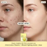 Anua Vitamin C Blemish Serum Mask - Image 2