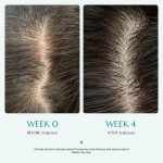 lilyeve Scalp Turn Cica PDRN Brush Ampoule 30ml - Image 6